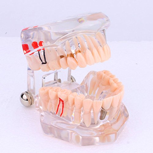 Walfront Transparentni stomatološki studij Podučavanje zuba Model odrasli tipki tipdodont Assort zubi desni desni za njegu zuba Studija